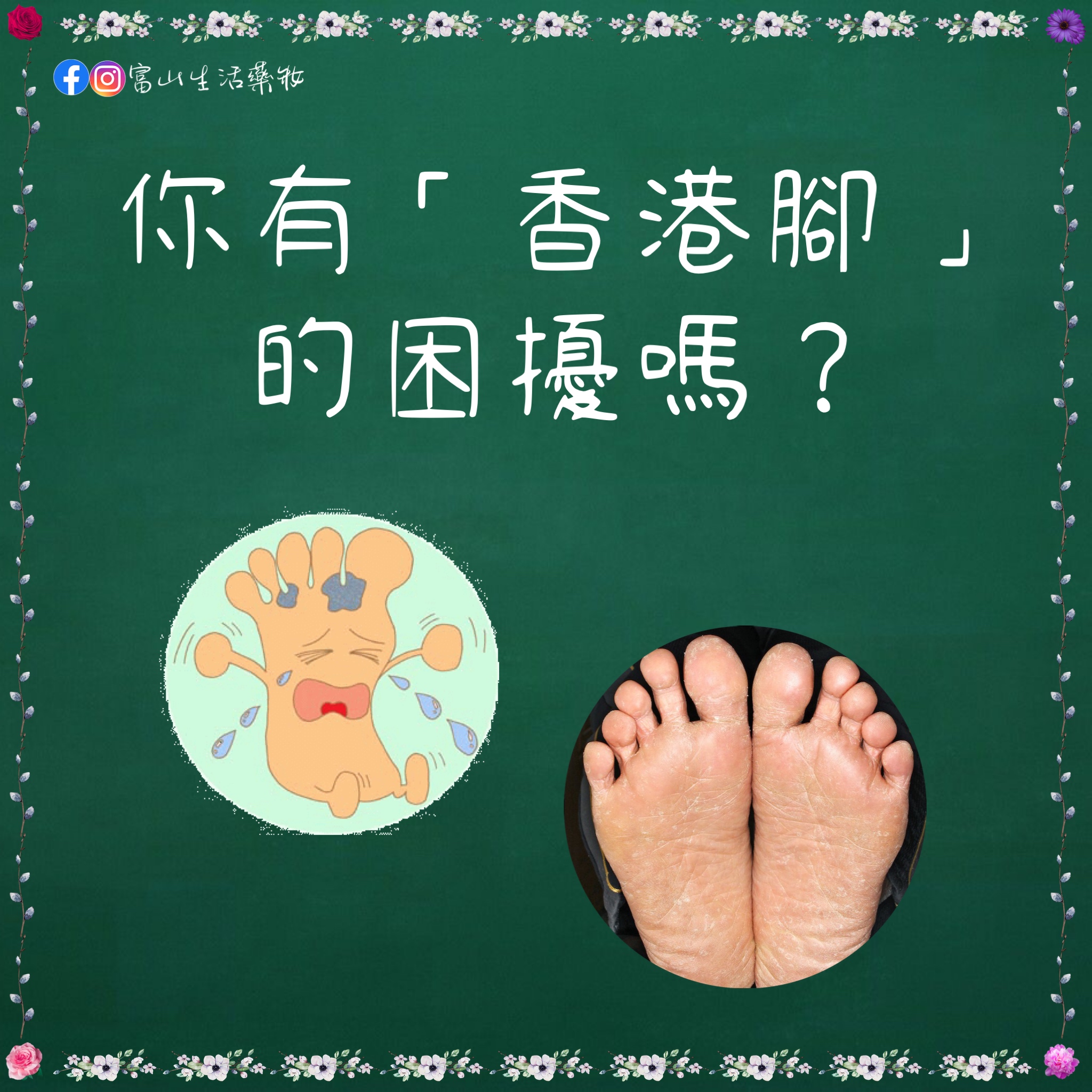 你也有「香港腳」的困擾嗎？